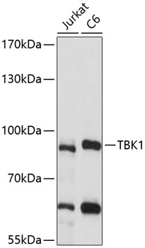 Western blot - TBK1 Polyclonal Antibody 