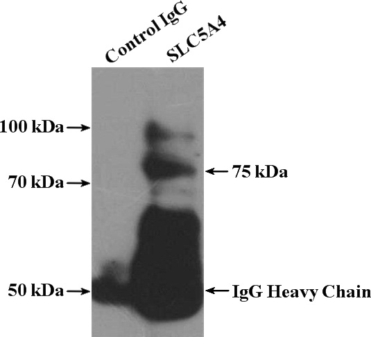 IP Result of anti-SLC5A4 (IP:Catalog No:115170, 4ug; Detection:Catalog No:115170 1:500) with mouse kidney tissue lysate 4000ug.