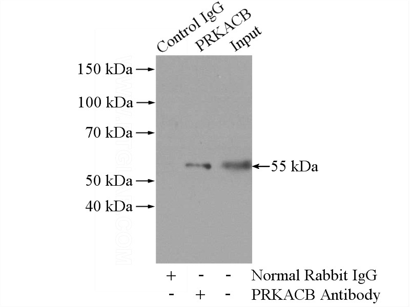 IP Result of anti-PRKACB (IP:Catalog No:114194, 4ug; Detection:Catalog No:114194 1:500) with mouse brain tissue lysate 2640ug.