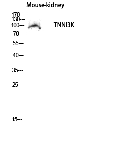 Fig1:; Western blot analysis of Mouse-kidney lysis using TNNI3K antibody. Antibody was diluted at 1:500. Secondary antibody（catalog#: HA1001) was diluted at 1:20000
