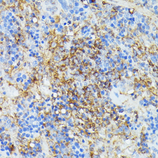 Immunohistochemistry - COX15 Polyclonal Antibody 