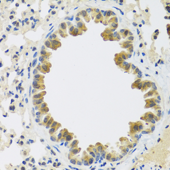 Immunohistochemistry - CRTAP Polyclonal Antibody 