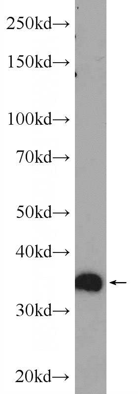 Neuro-2a cells were subjected to SDS PAGE followed by western blot with Catalog No:112413(LYSMD3 Antibody) at dilution of 1:300