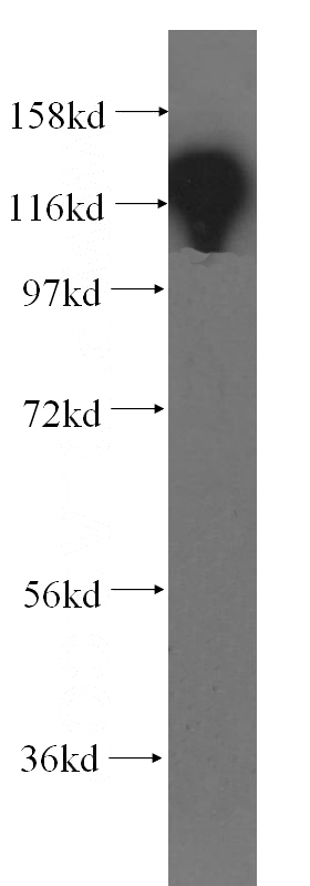 human kidney tissue were subjected to SDS PAGE followed by western blot with Catalog No:110239(EMILIN1 antibody) at dilution of 1:300