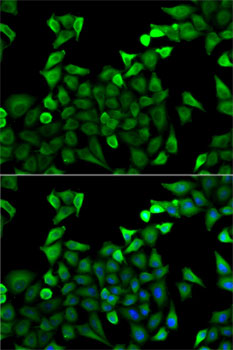 Immunofluorescence - TPSAB1 Polyclonal Antibody 