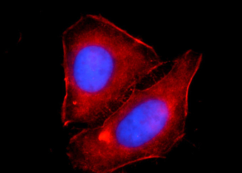 Immunofluorescent analysis of HepG2 cells using Catalog No:107862(ACTA1 Antibody) at dilution of 1:50 and Rhodamine-Goat anti-Rabbit IgG