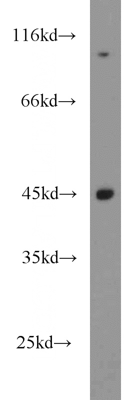 SGC-7901 cells were subjected to SDS PAGE followed by western blot with Catalog No:116684(USP45 antibody) at dilution of 1:1500
