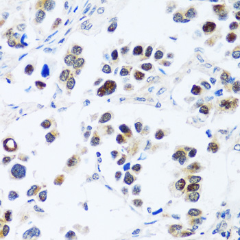 Immunohistochemistry - BRIX1 Polyclonal Antibody 