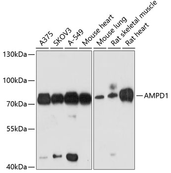 Western blot - AMPD1 Polyclonal Antibody 