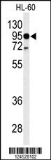 Western blot analysis of TLR4 Antibody (Center) (Cat. #169131) in HL-60 cell line lysates (35ug/lane). TLR4 (arrow) was detected using the purified Pab.