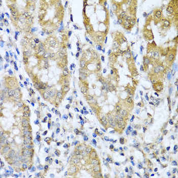 Immunohistochemistry - ASIP Polyclonal Antibody 