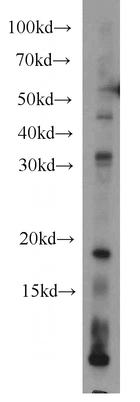 mouse cerebellum tissue were subjected to SDS PAGE followed by western blot with Catalog No:114839(RPS27A antibody) at dilution of 1:300