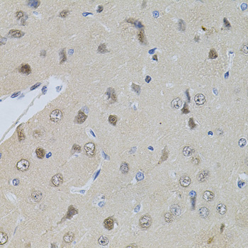 Immunohistochemistry - POP4 Polyclonal Antibody 
