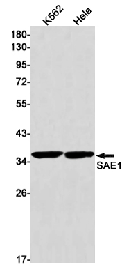Western blot detection of SAE1 in K562,Hela cell lysates using SAE1 Rabbit mAb(1:1000 diluted).Predicted band size:39kDa.Observed band size:39kDa.