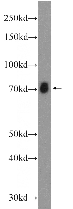 rat brain tissue were subjected to SDS PAGE followed by western blot with Catalog No:108229(ACCN1 Antibody) at dilution of 1:300