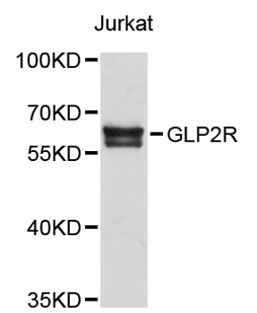 Western blot - GLP2R Polyclonal Antibody 