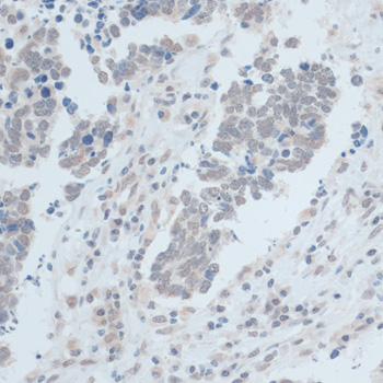 Immunohistochemistry - ZNF703 Polyclonal Antibody 