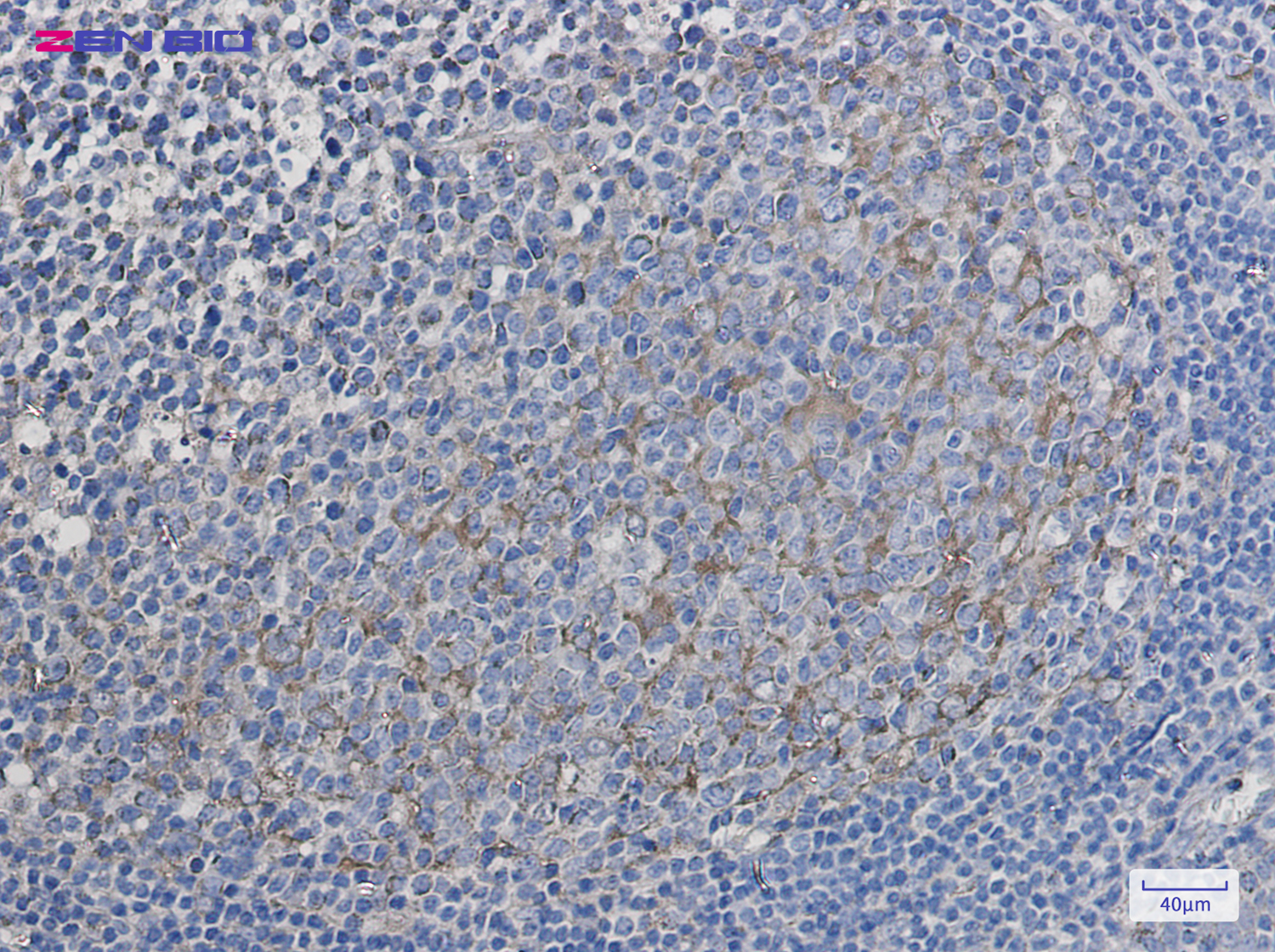Immunohistochemistry of Citrate synthetase in paraffin-embedded Human tonsil using Citrate synthetase Rabbit pAb at dilution 1/50