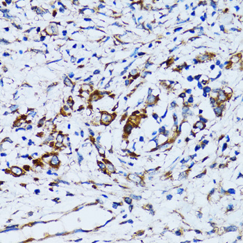 Immunohistochemistry - RARS Polyclonal Antibody 
