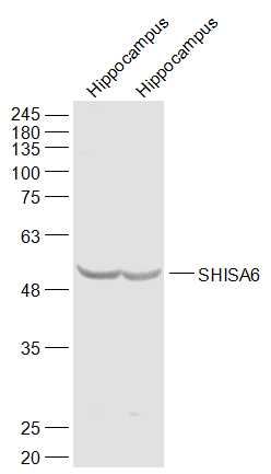 Fig1: Sample:; Hippocampus (Mouse) Lysate at 40 ug; Hippocampus (Rat) Lysate at 40 ug; Primary: Anti-SHISA6 at 1/1000 dilution; Secondary: IRDye800CW Goat Anti-Rabbit IgG at 1/20000 dilution; Predicted band size: 53 kD; Observed band size: 53 kD