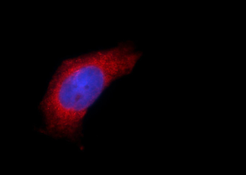 Immunofluorescent analysis of HeLa cells using Catalog No:112757(MPV17 Antibody) at dilution of 1:25 and Alexa Fluor 594-congugated AffiniPure Goat Anti-Rabbit IgG(H+L)