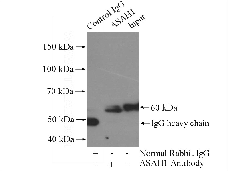 IP Result of anti-ASAH1 (IP:Catalog No:108209, 4ug; Detection:Catalog No:108209 1:300) with mouse brain tissue lysate 3200ug.