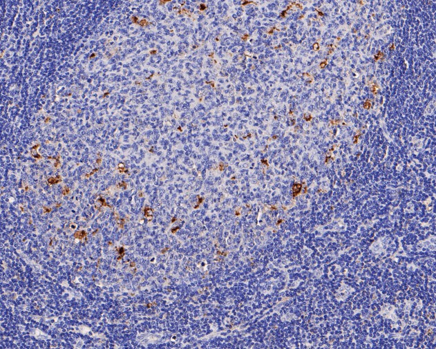 Fig2:; Immunohistochemical analysis of paraffin-embedded human tonsil tissue using anti-CD68 antibody. The section was pre-treated using heat mediated antigen retrieval with Tris-EDTA buffer (pH 8.0-8.4) for 20 minutes.The tissues were blocked in 5% BSA for 30 minutes at room temperature, washed with ddH; 2; O and PBS, and then probed with the primary antibody ( 1/200) for 30 minutes at room temperature. The detection was performed using an HRP conjugated compact polymer system. DAB was used as the chromogen. Tissues were counterstained with hematoxylin and mounted with DPX.