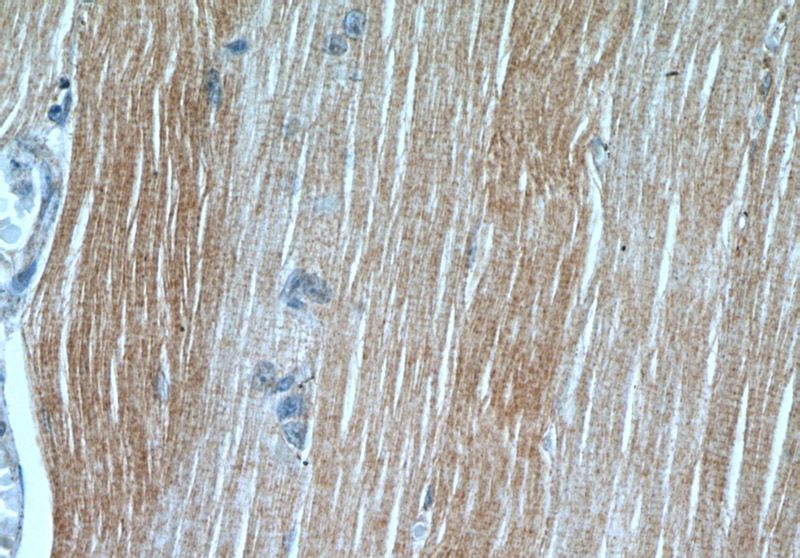 Immunohistochemical of paraffin-embedded human skeletal muscle using Catalog No:113927(PLA2G4E antibody) at dilution of 1:50 (under 40x lens)