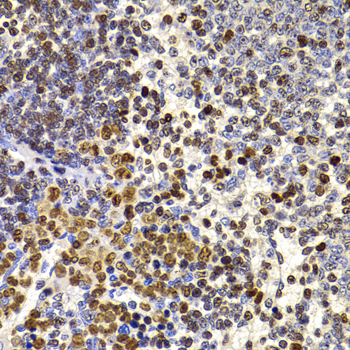 Immunohistochemistry - HIRIP3 Polyclonal Antibody 