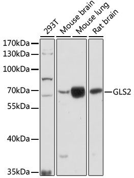 Western blot - GLS2 Polyclonal Antibody 