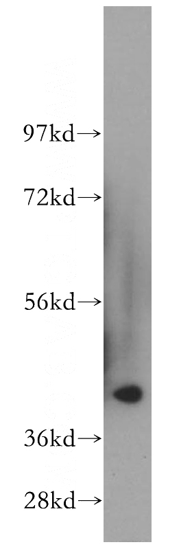 human kidney tissue were subjected to SDS PAGE followed by western blot with Catalog No:111543(HSD11B2 antibody) at dilution of 1:300