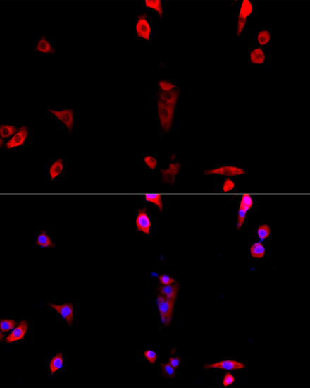 Immunofluorescence - EIF3J Polyclonal Antibody 