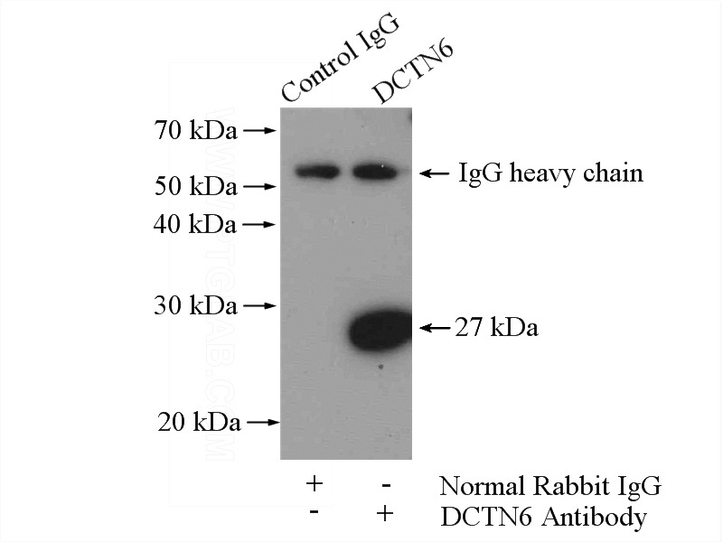 IP Result of anti-DCTN6 (IP:Catalog No:109761, 4ug; Detection:Catalog No:109761 1:500) with mouse testis tissue lysate 4800ug.