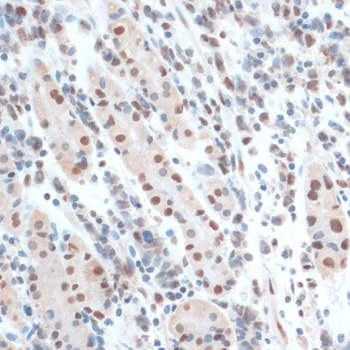 Immunohistochemistry - ZNF433 Polyclonal Antibody 