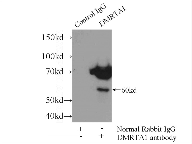 IP Result of anti-DMRTA1 (IP:Catalog No:110006, 3ug; Detection:Catalog No:110006 1:500) with mouse liver tissue lysate 3000ug.