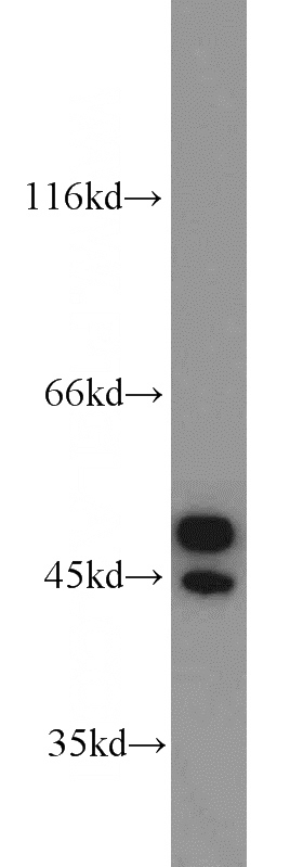 mouse heart tissue were subjected to SDS PAGE followed by western blot with Catalog No:108098(ANXA7 antibody) at dilution of 1:1000