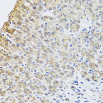 Immunohistochemistry - PER1 Polyclonal Antibody 