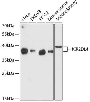 Western blot - KIR2DL4 Polyclonal Antibody 