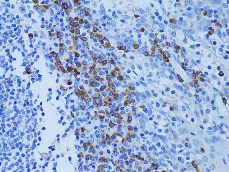 Immunohistochemistry - ATG7 Polyclonal Antibody. Immunohistochemistry of paraffin-embedded human tonsil using ATG7 antibody at dilution of 1:100 (40x lens).