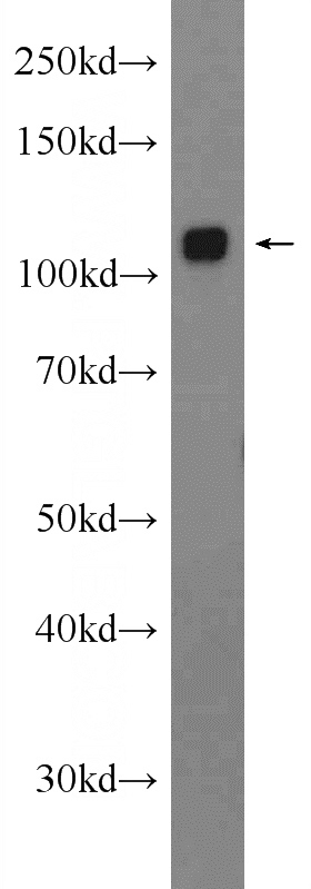 mouse liver tissue were subjected to SDS PAGE followed by western blot with Catalog No:111020(GLDC Antibody) at dilution of 1:1000