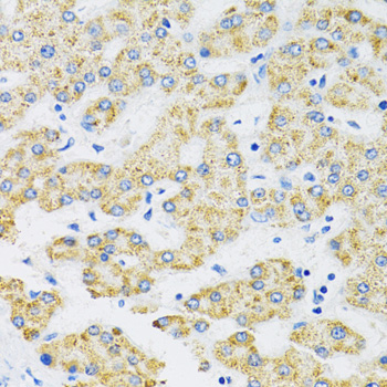Immunohistochemistry - SLC16A4 Polyclonal Antibody 