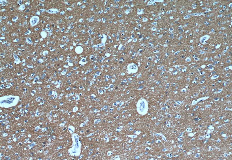 Immunohistochemical of paraffin-embedded human brain using Catalog No:108344(ATP1B1 antibody) at dilution of 1:50 (under 10x lens)