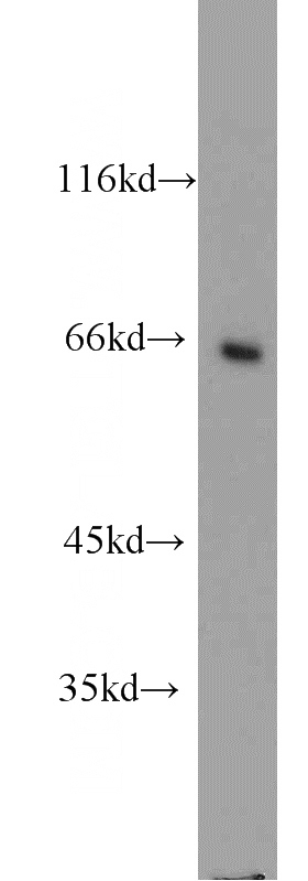 COLO 320 cells were subjected to SDS PAGE followed by western blot with Catalog No:112205(LGALS3BP antibody) at dilution of 1:1000