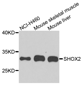 Western blot - SHOX2 Polyclonal Antibody 