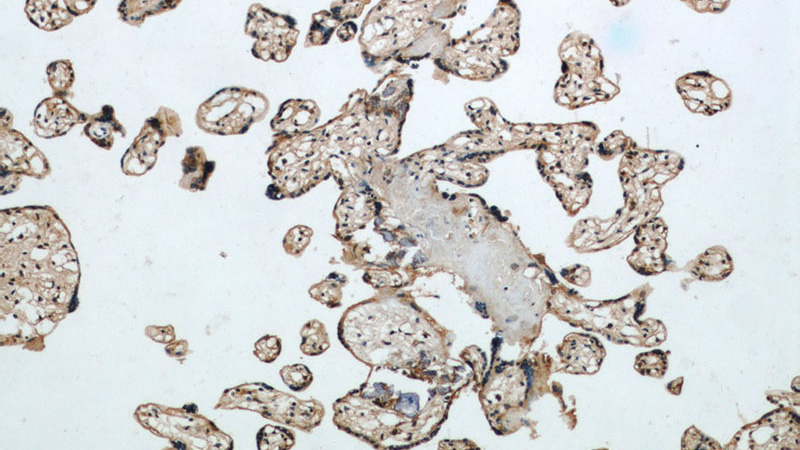 Immunohistochemical of paraffin-embedded human placenta using Catalog No:110383(EPHB4 antibody) at dilution of 1:50 (under 10x lens)