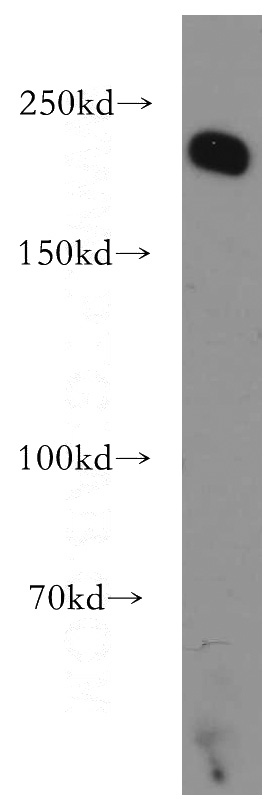 MCF7 cells were subjected to SDS PAGE followed by western blot with Catalog No:111864(ITGB4 antibody) at dilution of 1:500