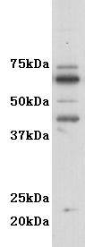 Fig1: Western blot analysis on F9 cell lysates using anti- GM-CSF-R-alpha polyclonal antibody.