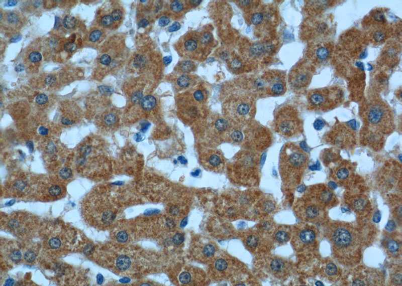 Immunohistochemistry of paraffin-embedded human liver tissue slide using Catalog No:107972(ALDH5A1 Antibody) at dilution of 1:50 (under 40x lens)