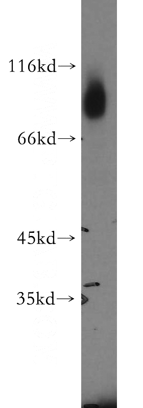 human skeletal muscle tissue were subjected to SDS PAGE followed by western blot with Catalog No:110951(GFPT1 antibody) at dilution of 1:500