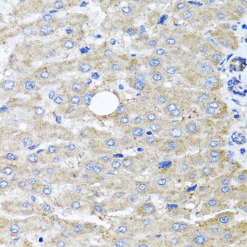 Immunohistochemistry - DFNA5 Polyclonal Antibody 